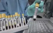 P03 P03
